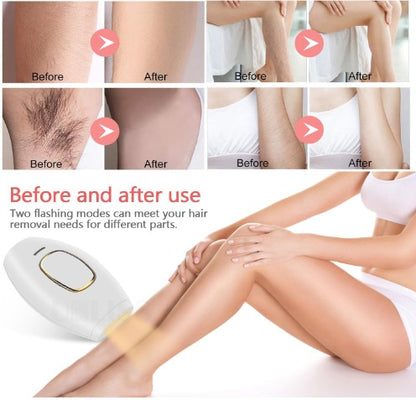 Depiladora Laser IPL