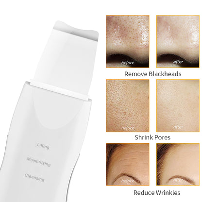 Limpiador Facial 3 en 1 Acné espinillas